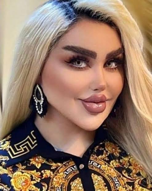 43 Surgeries to Look Like a Doll Spark Controversy